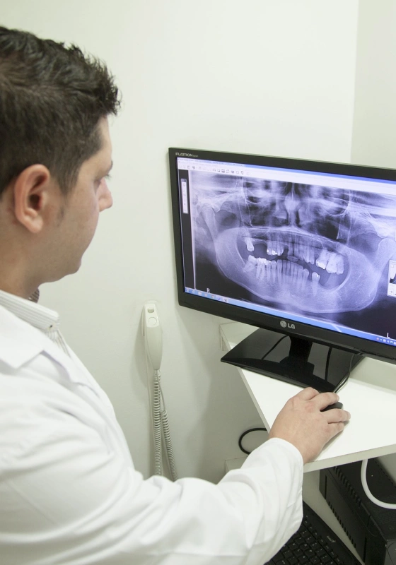 candidate for dental implants x-ray