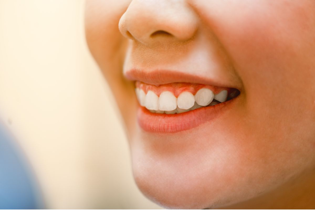 Why Choose a Prosthodontist for Smile Rehabilitation?