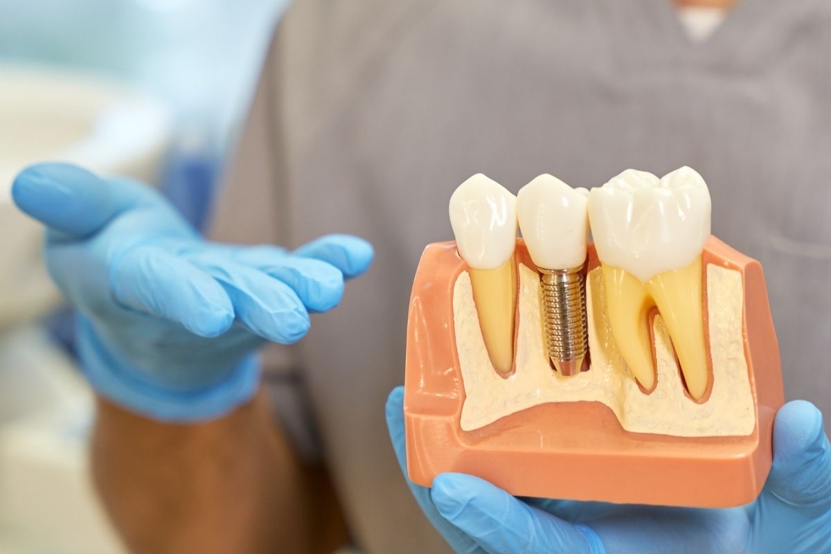 What Does a Dentist Do During an Implant Consultation?