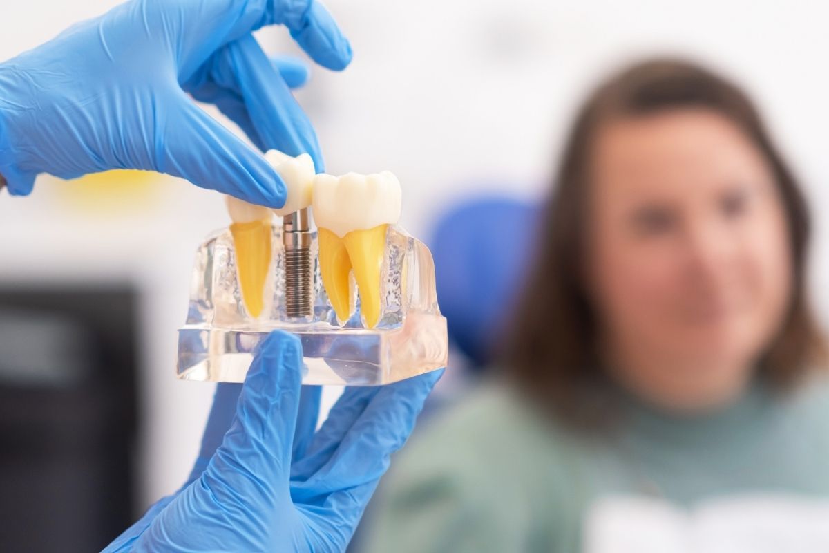 How Soon Can I Return to Work After Dental Implants Surgery?