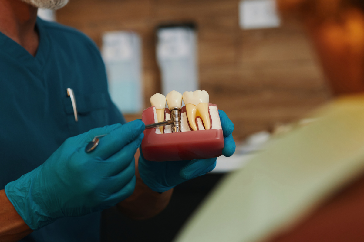 Missing Teeth? How Your Dentist Plans the Right Implant Solution